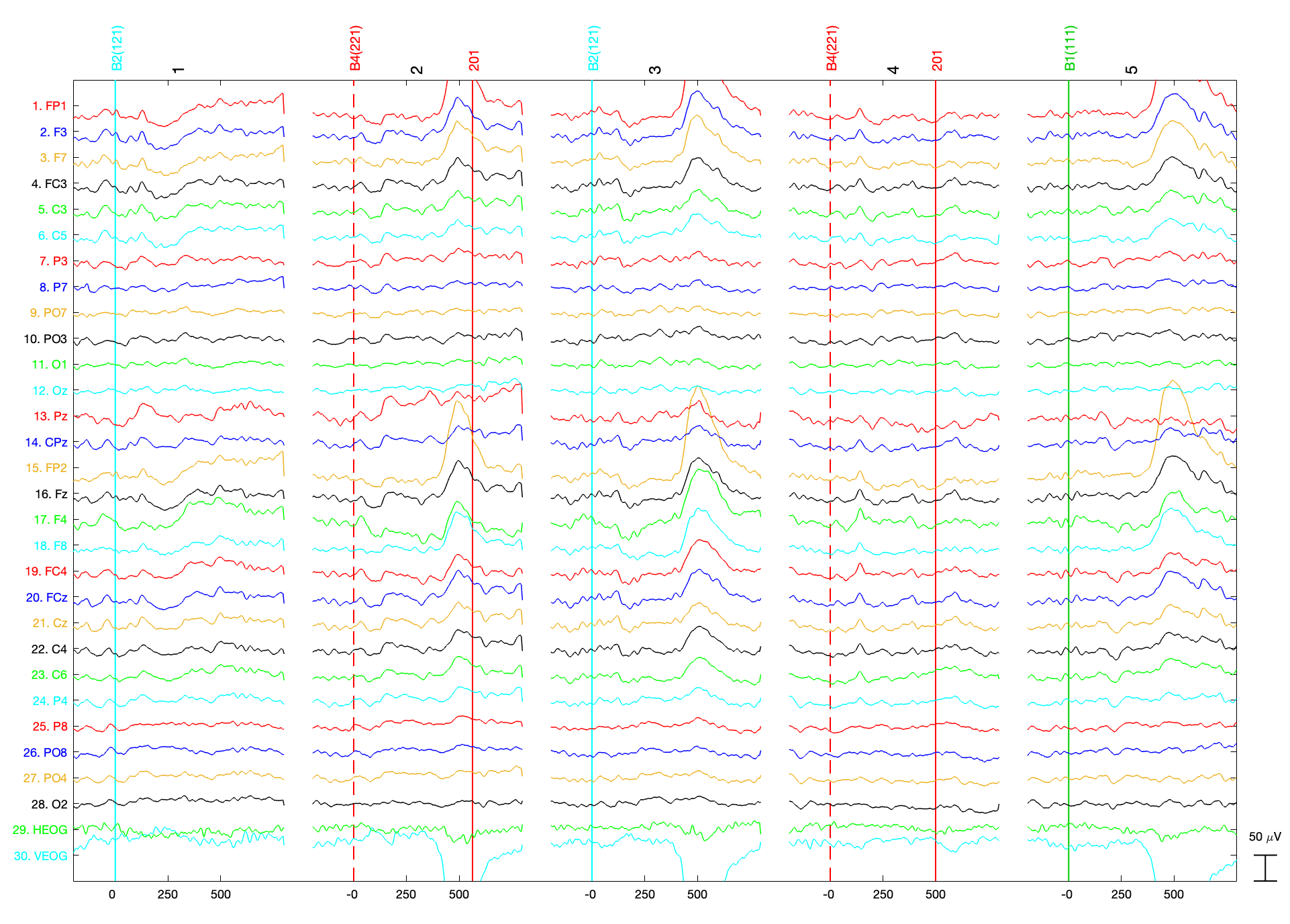 Epoched EEG